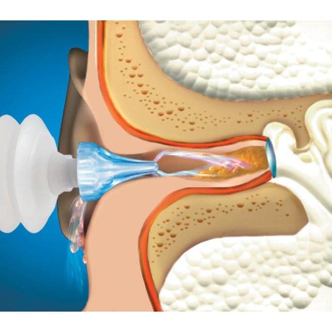 Macks ProRinse Earwax Removal Syringe